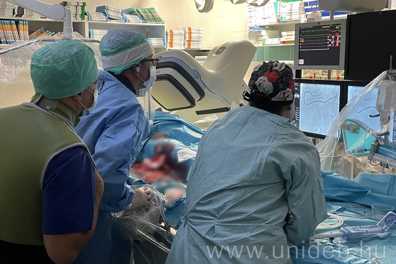 Új technológiával kezeltek a Debreceni Klinikán súlyosan meszes koszorúér szűkületet